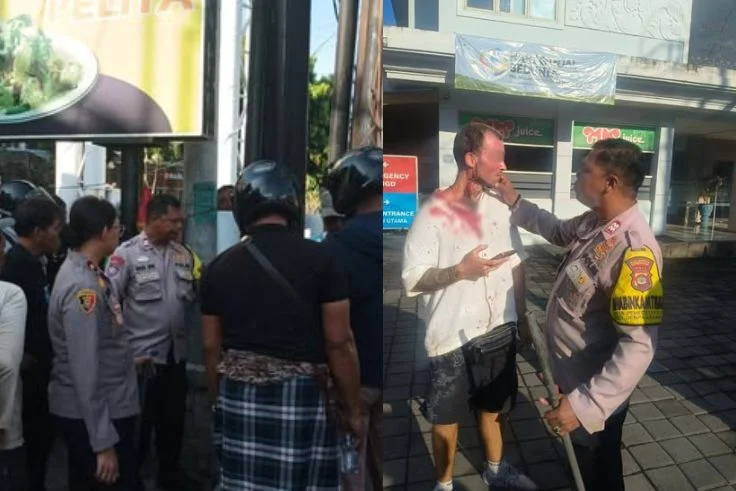 Bule Ngamuk di Gym Denpasar Barat, Kasus Penganiayaan WNA Prancis Bikin Heboh